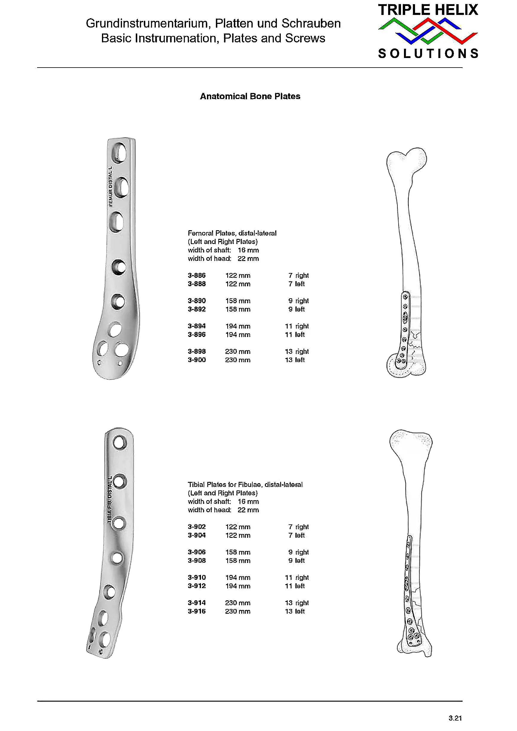 Anatomical Femoral Bone Plates