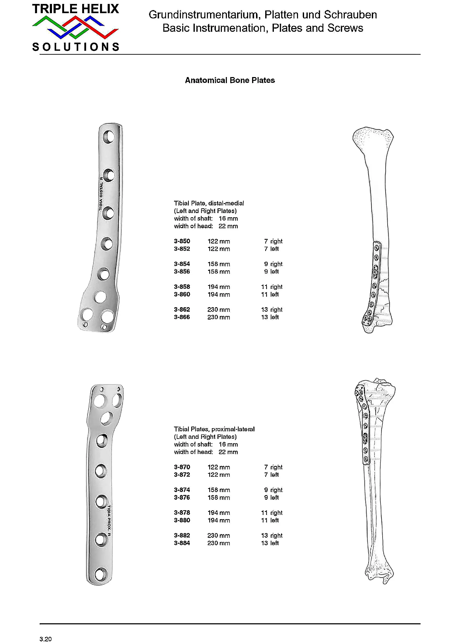 Anatomical Tibial Bone Plates